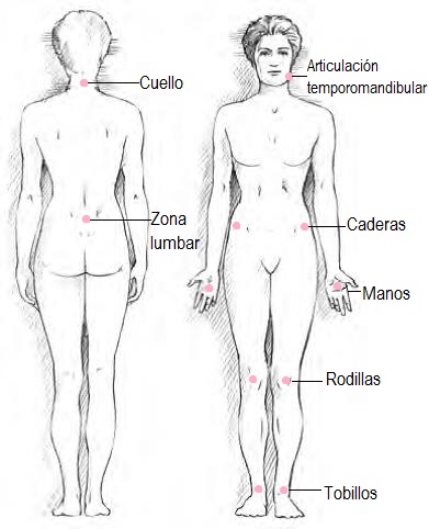 que es la osteoartritis